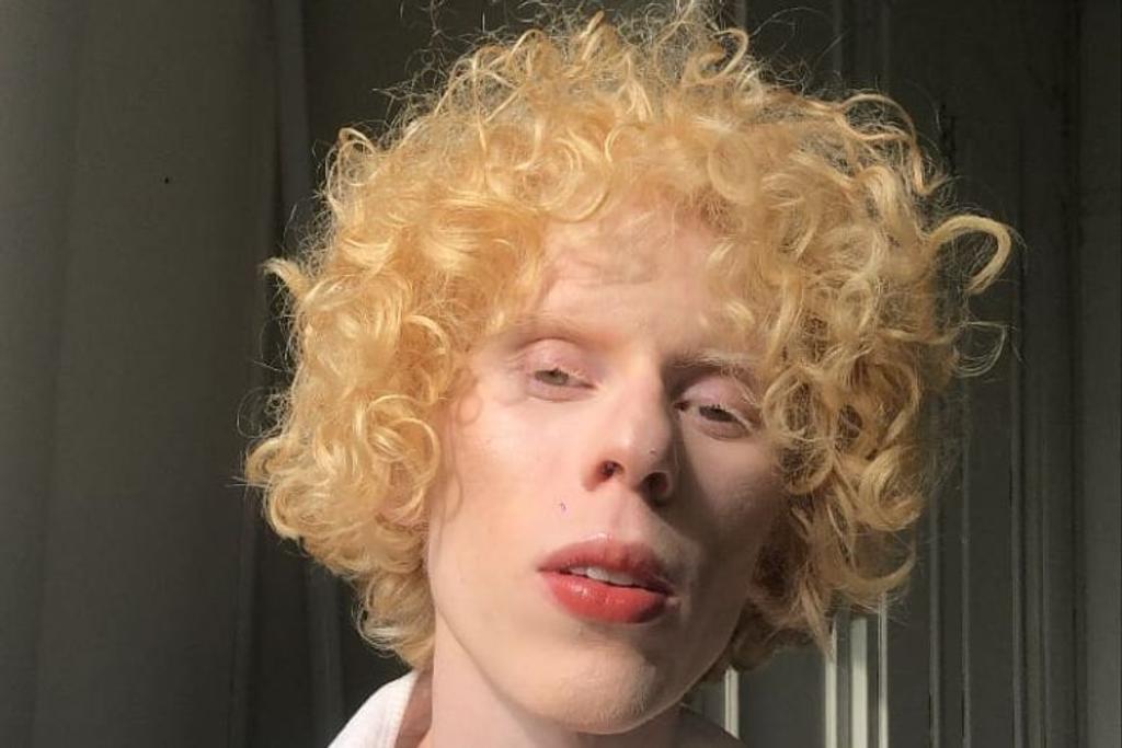 Albino, Genetic mutation, Unique