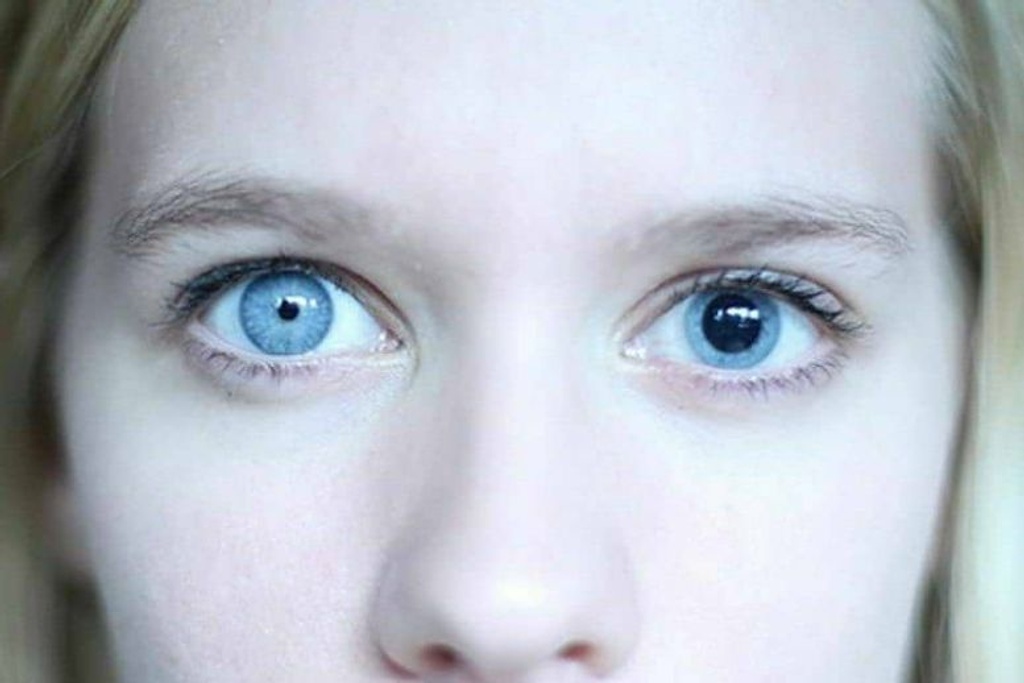 pupils rare eyes unique