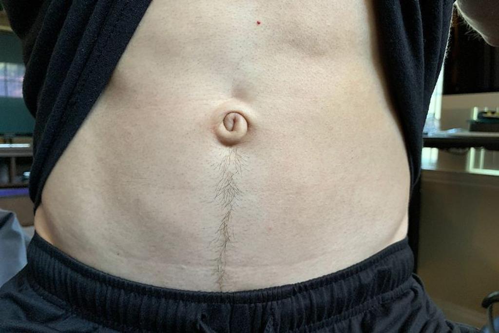 belly button shape rare