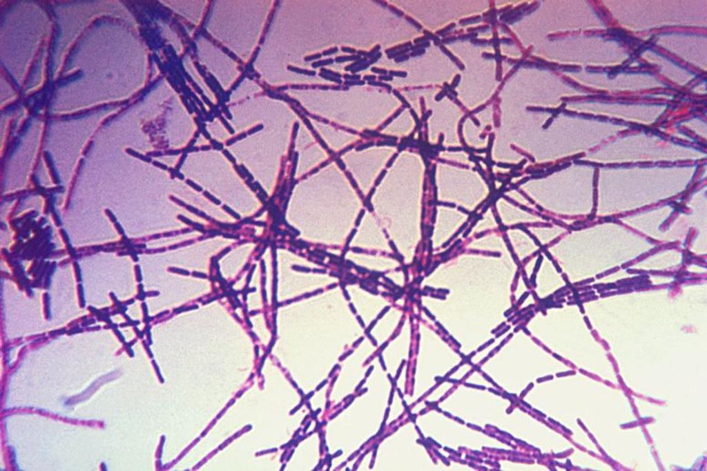 anthrax virus permafrost dangerous