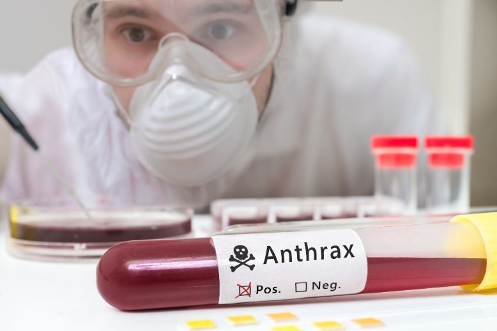 anthrax bacteria 