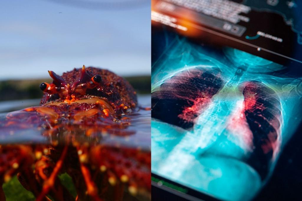 lobster xray vision technology