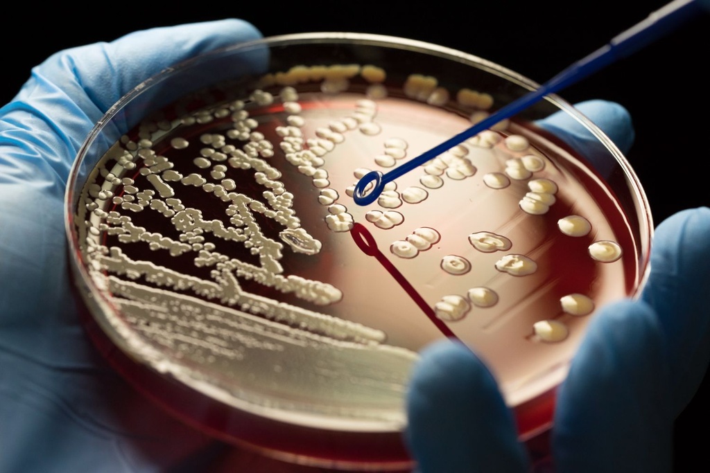 Antibiotic Resistant MRSA Bacteria 
