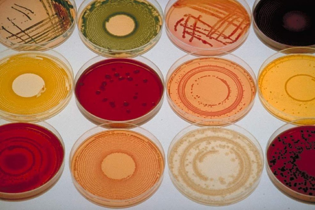 mutant bacteria van gogh