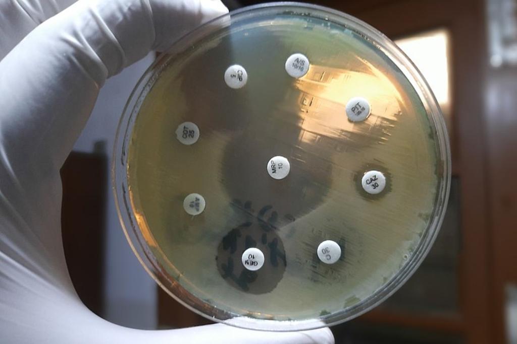 Dark Clouds Drug-Resistant Bacteria
